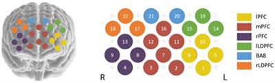 Comparison of different rhythmic auditory stimuli on prefrontal cortex cortical activation during upper limb movement in patients with Parkinson’s disease: a functional near-infrared spectroscopy study